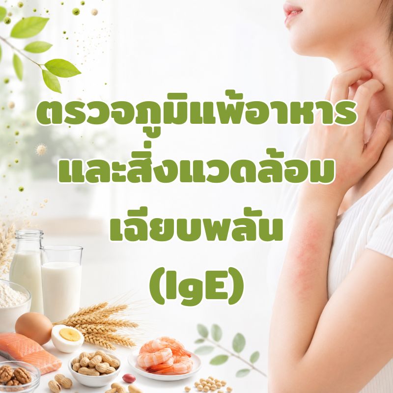 [E-Voucher] Food and Environmental Allergens test (IgE) ราคา 5,900 บาท*ส่งฟรี
