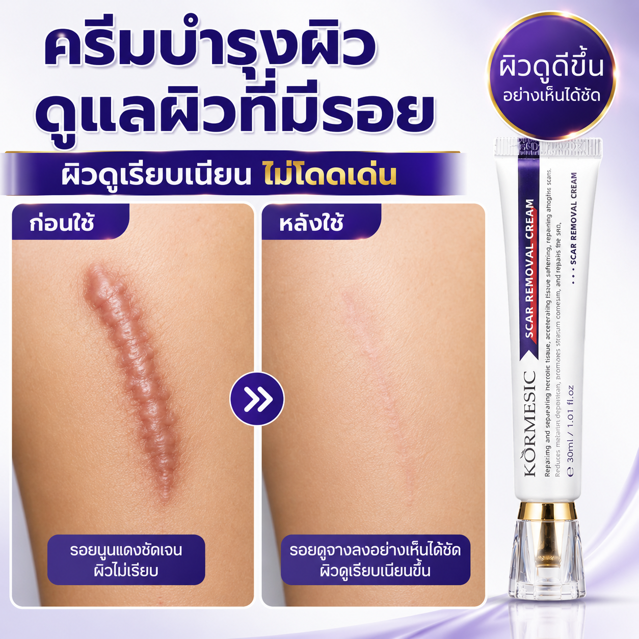 Scar Removal Cream Helps Old Scars and Dark Spots Fade Away. Restores the Skin to Be Smooth and Healthy-Looking. Scar Cream ราคา 169 บาท*ส่งฟรี