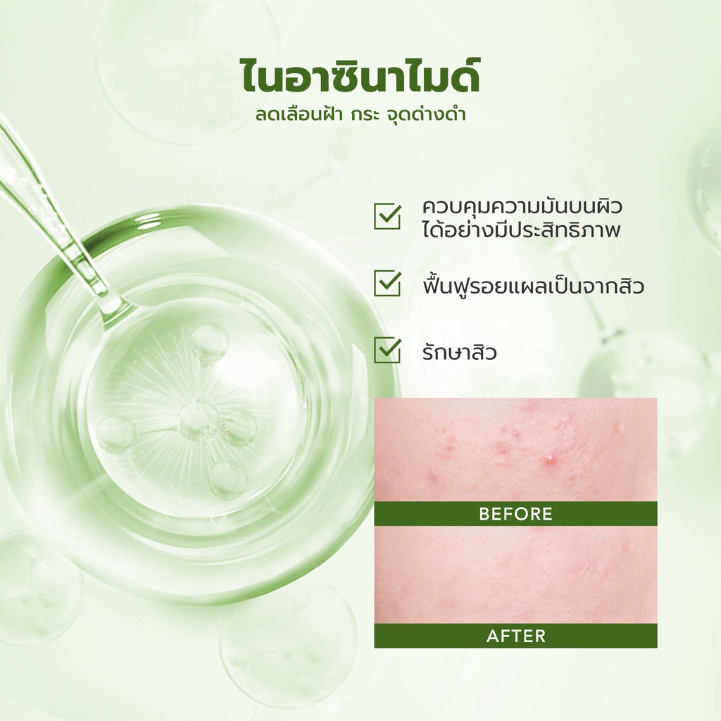 YOU Acneplus Niacinamide, 4D CICA Rapid Anti Acne Removal Spot Care 15g บาล์มแต้มสิวใบบัวบก กำจัดสิวอย่างรวดเร็ว 0e5637d7aa2fe76554ce9e815a5b1a01