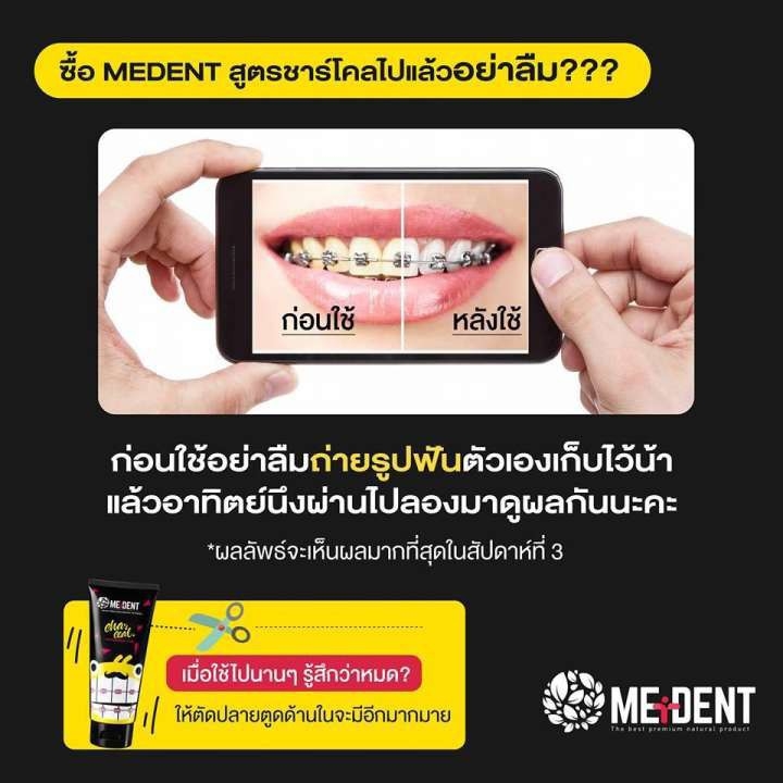 MEDENT แปรงสีฟันสำหรับคนจัดฟัน รุ่น สไปรัล ยู ซอฟ (Spiral U Soft)แปรงสีฟัน นุ่ม อ่อนโยน ละมุนจนไม่อยากหยุดแปรง
