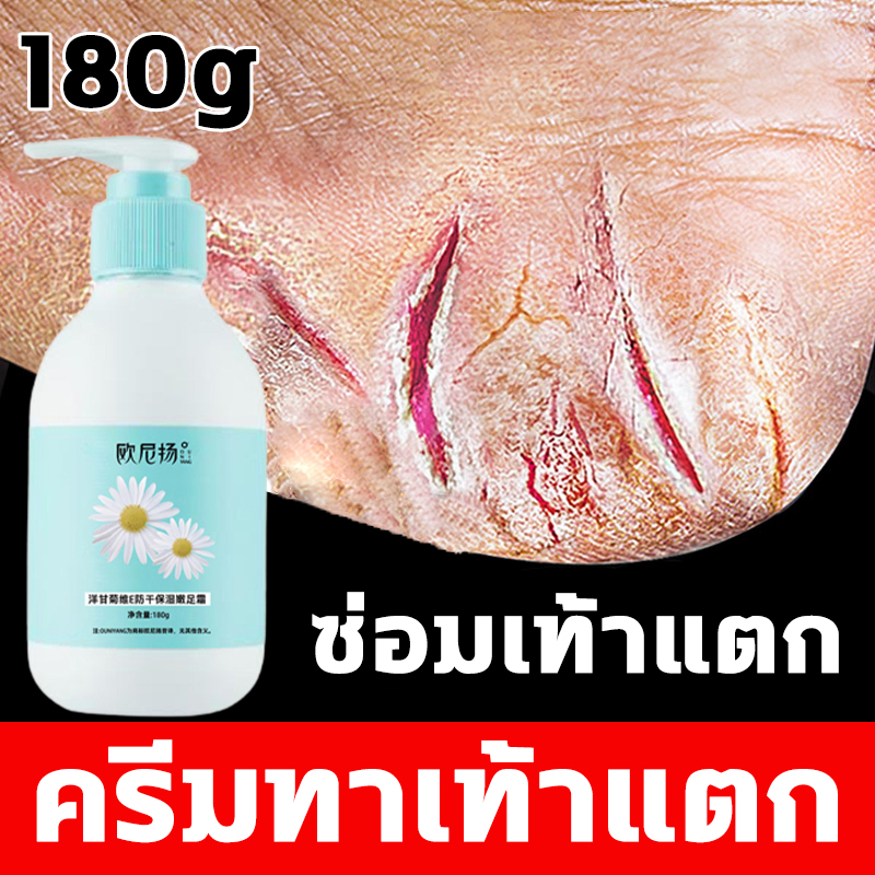 ??เท้าแตก หายได้ในสามวัน?? ครีมทาเท้าแตก ครีมส้นเท้าแตก ครีมทาเท้า ครีมทาส้นเท้า เหมาะสำหรับส้นเท้าแตก บำรุงและล็อคความชื้น ป้องกันการแตกร้าว ป้องกันแคลลัส ต่อต้านหยาบ ครีมน้ำมันม้า ครีมทาส้นเท้าแตก การดูแลหนังกำพร้า ครีมบำรุงส้นเท้า ครีมทาส้นแตก