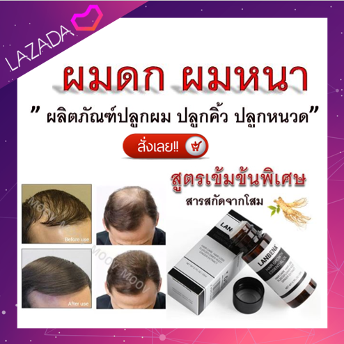 น้ำยาปลูกผม ปลูกคิ้ว ปลูกหนวด Lanbena(สูตรเข้มข้น) ยาปลูกผม ช่วยลดผมร่วง ปลูกผมหนา บำรุงรากผมใหม่ให้แข็งแรง ไม่ทำลายหนังศีรษะ ผลิตจากสารสกัดจากธรรมชาติ ผมจะหนาและดูแน่นขึ้นชัดเจนเมื่อใช้เป็นประจำ!!!ขนาด 20 มล.