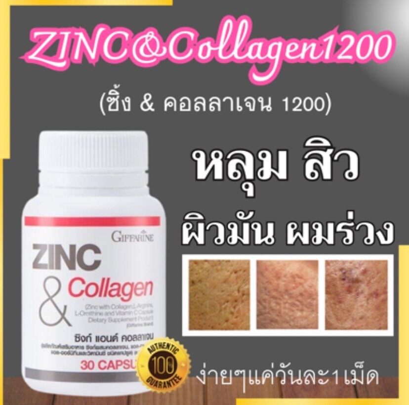 ส่งฟรี อาหารเสริมสำหรับสีว สีวอัก เสบ ซิงค์ วิตามินช่วยเรื่องผมและสิว คอลลาเจนซิงค์ ราคา 468 บาท*ส่งฟรี