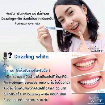 Dazzling White Pen - Professional Strength Whitening Pen June 2018 - 3 Dazzling White Pen - Professional Strength Whitening Pen - 3