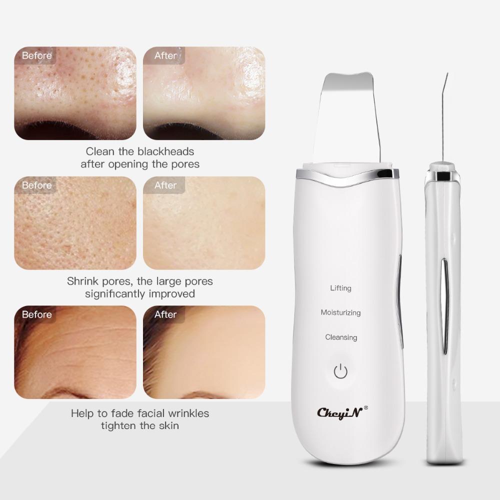 Ultrasonic NANO Ion Scrubber ทำความสะอาด Face Lifting Peeling ...