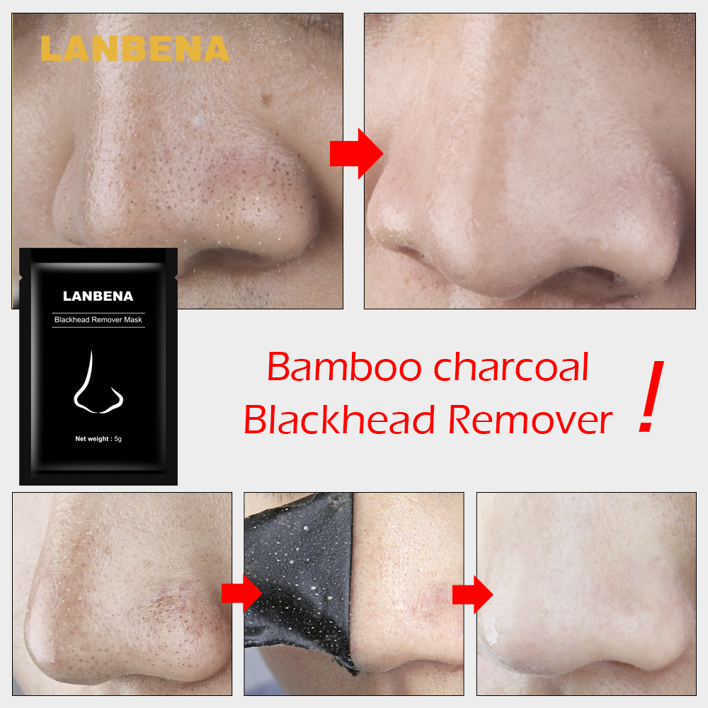 ภาพประกอบของ LANBENA Blackhead Remover Mask 5g.มาส์กลอกสิวโคลนมาร์คหน้าถ่านดำลอกสิวเสี้ยนโคลนลอกสิวเสี้ยนครีมลอกสิว-0113