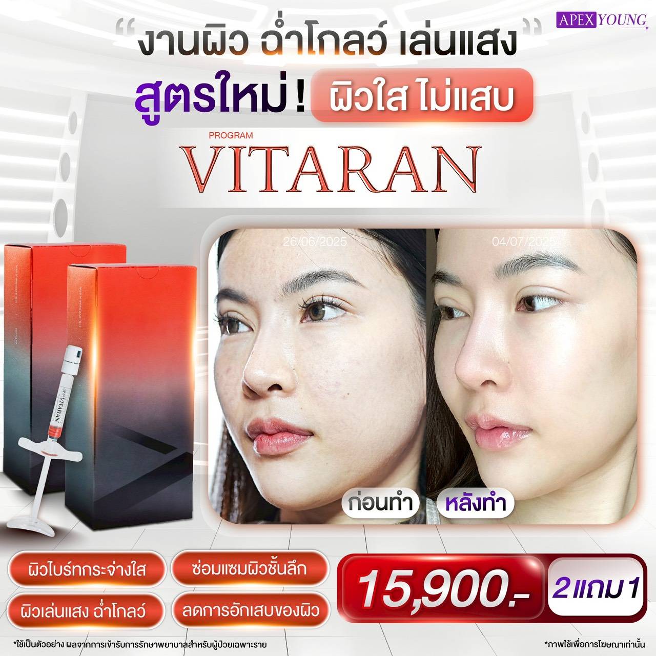 [E-Voucher] Apex Vitaran Program for Clear Skin, Glowing Skin, and Rapid Reduction of Inflammation. Skin Clears up Quickly Without Irritating the Skin. ราคา 15,900 บาท*ส่งฟรี