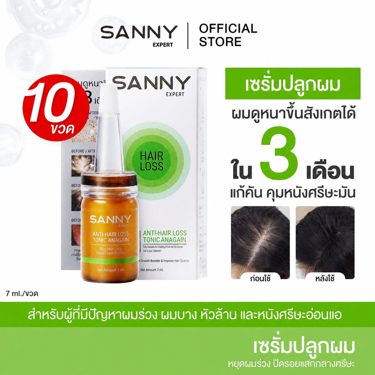 SANNY ANAGAIN ANTI-HAIR LOSS TONIC 10 BOTTLE ราคา 1,450 บาท*ส่งฟรี