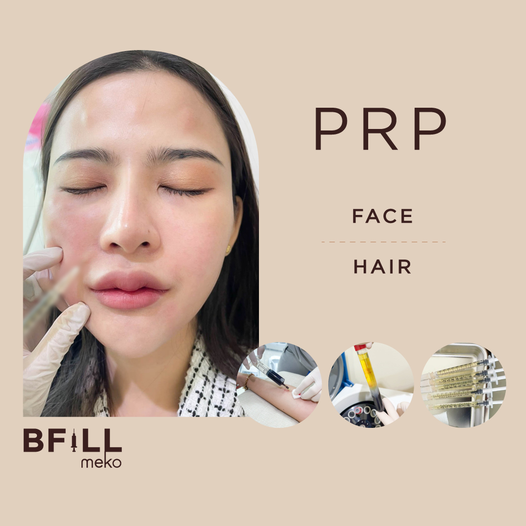 [E-voucher] Meko Bfill Clinic PRP หน้าใสด้วย Stem cell จากเลือดตัวเอง ราคา 999 บาท*ส่งฟรี