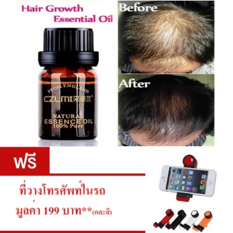 ลดราคา ผลิตภัณฑ์ ดูแลผม ใช้ได้ทั้งชายหญิง ป้องกันผมหลุดร่วง บำรุงเส้นผม และ หนังศีรษะ ป้องกันหัวล้าน ปลูกผม จำนวน 1 กล่อง ฟรี ที่วางโทรศัพท์ในรถ*คละสี*จำนวน 1 ชิ้น มูลค่า 199 บาท ขายด่วน ผลิตภัณฑ์ ดูแลผม ใช้ได้ทั้งชายหญิง ป้องกันผมหลุดร่วง บำรุงเส้นผม และ หนังศีรษะ ป้องกันหัวล้าน ปลูกผม จำนวน 1 กล่อง ฟรี ที่วางโทรศัพท์ในรถ*คละสี*จำนวน 1 ชิ้น มูลค่า 199 บาท