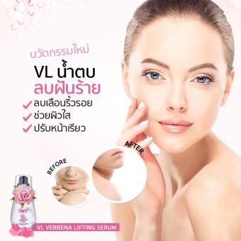 Dora : VL Verbena Lifting Serum ( VL น้ำตบยกกระชับ หน้าเรียว) July 2018 - 2 Dora : VL Verbena Lifting Serum ( VL น้ำตบยกกระชับ หน้าเรียว) - 2