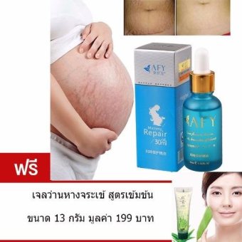 AIVOYE ครีมแก้ท้องลาย ลดรอยแตกลาย 30 มล. แถม เจลว่านหางจระเข้ลดรอยสิว ขนาด 13 กรัม มูลค่า 199.- AIVOYE ครีมแก้ท้องลาย ลดรอยแตกลาย 30 มล. แถม เจลว่านหางจระเข้ลดรอยสิว ขนาด 13 กรัม มูลค่า 199.-