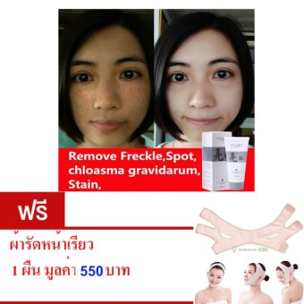SNaZII มาส์คหน้าใส ลบเลือนจุดด่างดำ ให้ความชุ่มชื้น รักษาสิว ขนาด 40 กรัม.ฟรี ผ้ารัดหน้าเรียว สีเนื้อ 1 ผืน มูลค่า 550 บาท SNaZII มาส์คหน้าใส ลบเลือนจุดด่างดำ ให้ความชุ่มชื้น รักษาสิว ขนาด 40 กรัม.ฟรี ผ้ารัดหน้าเรียว สีเนื้อ 1 ผืน มูลค่า 550 บาท