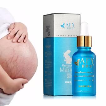 AIVOYE ครีมสมุนไพรจีนแก้ท้องลาย ลดรอยแตกลาย 30 ml. AIVOYE ครีมสมุนไพรจีนแก้ท้องลาย ลดรอยแตกลาย 30 ml.