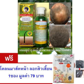 แชมพูสมุนไพร ช่วยลดอาการผมร่วง ปลูกผมให้ดำเงางาม บำรุงรากผมให้แข็งแรง ไม่หลุดร่วงง่าย แถมฟรี โคลนมาส์คหน้าลอกสิวเสี้ยน จำนวน 1 ซอง มูลค่า 79.- แชมพูสมุนไพร ช่วยลดอาการผมร่วง ปลูกผมให้ดำเงางาม บำรุงรากผมให้แข็งแรง ไม่หลุดร่วงง่าย แถมฟรี โคลนมาส์คหน้าลอกสิวเสี้ยน จำนวน 1 ซอง มูลค่า 79.-