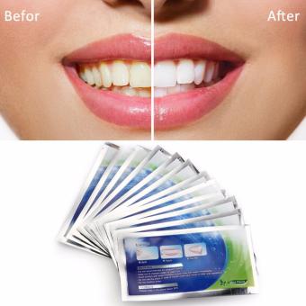 Advance teeth whiteningแผ่นฟอกฟันขาว ฟอกสีฟัน ทำด้วยตนเอง 1กล่อง (14ซอง28ชิ้น) Advance teeth whiteningแผ่นฟอกฟันขาว ฟอกสีฟัน ทำด้วยตนเอง 1กล่อง (14ซอง28ชิ้น)