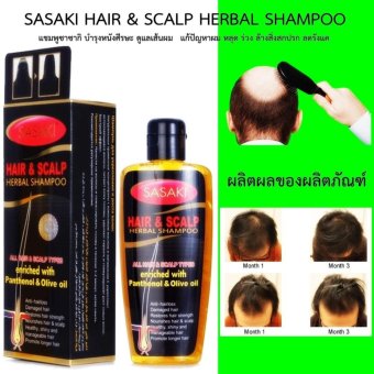 SASAKI HAIR & SCALP HERBAL SHAMPOO แชมพูซาซากิ บำรุงหนังศีรษะ ดูแลเส้นผม ให้แข็งแรง ปลูกผม แก้ปัญหาผม หลุด ร่วง ล้างสิ่งสกปรก ลดรังแค แก้คันหนังศีรษะ ผมยาวสลวยดกดำ ประกายเงางามมีสุขภาพผมที่ดี 1 ขวด บรรจุ 240มล. 2 ชิ้น SASAKI HAIR & SCALP HERBAL SHAMPOO แชมพูซาซากิ บำรุงหนังศีรษะ ดูแลเส้นผม ให้แข็งแรง ปลูกผม แก้ปัญหาผม หลุด ร่วง ล้างสิ่งสกปรก ลดรังแค แก้คันหนังศีรษะ ผมยาวสลวยดกดำ ประกายเงางามมีสุขภาพผมที่ดี 1 ขวด บรรจุ 240มล. 2 ชิ้น