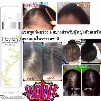 เซรั่มปลูกผม แชมพูแก้ผมร่วง ผมบาง ปลูกผมสำหรับผู้หญิง ฮาวิลาห์ เซรั่มปลูกผม แชมพูแก้ผมร่วง ผมบาง ปลูกผมสำหรับผู้หญิง ฮาวิลาห์