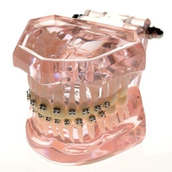 Xinxin Dental New Standard Study Model With Metal BracketOrthodontic Catface - intl Xinxin Dental New Standard Study Model With Metal BracketOrthodontic Catface - intl