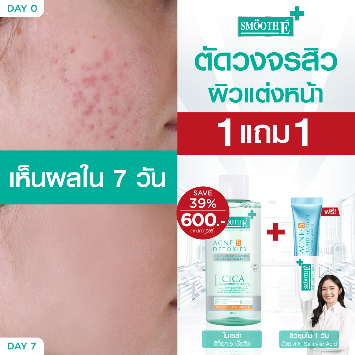 [เซ็ตสุดคุ้ม] Smooth E Cleansing water 400 ml. & Ance Hydrogel เซ็ทสิวหาย 2 สเต็ป: ดีท็อก 5 เชื้อสิว x ยุบไวใน 1 คืน ราคา 859 บาท*ส่งฟรี