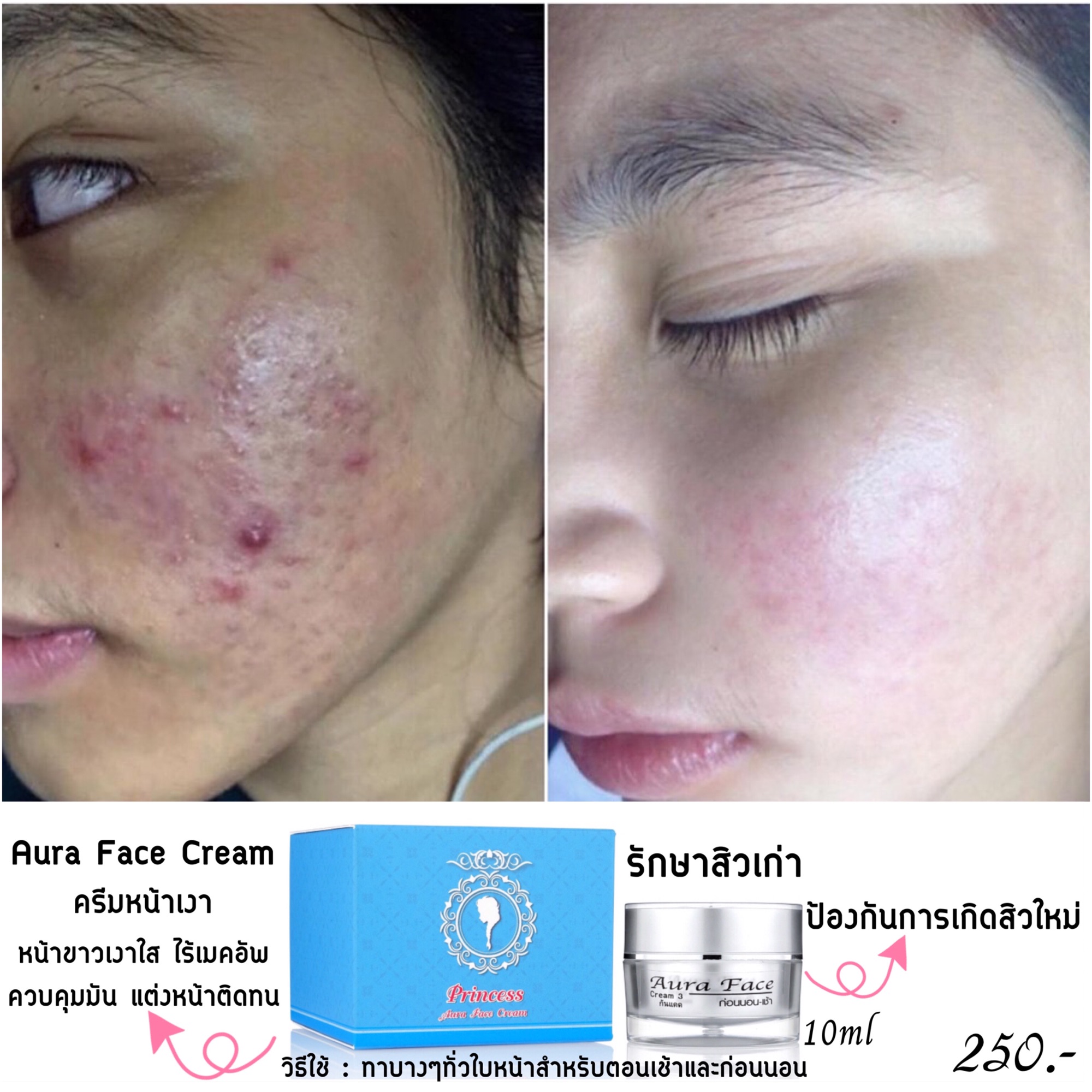 ??Aura Face Cream ครีมหน้าเงา ครีมทาหน้าเงา ครีมทาหน้า หน้าฉ่ำวาว ออร่า หน้าเงาโกลว์ ครีมหน้าใส ผิวหน้าไบรท์ หน้าวิ้งค์ ผิวหน้า คอลลาเจน