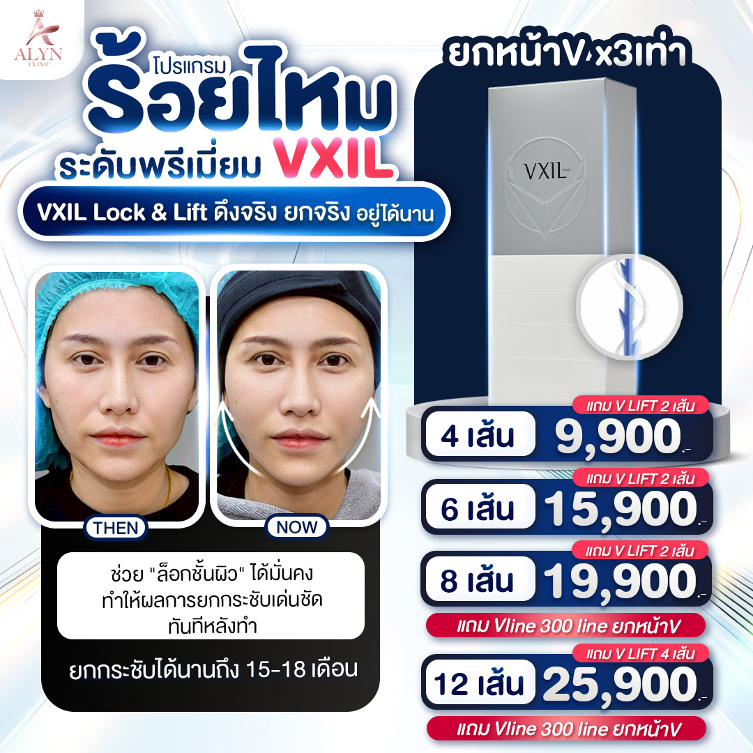 Premium Silk Thread Vxil Lock & Lift, Real Pulling Power, Real Lifting, Long Lasting, Alyn Clinic, Alin Clinic. ราคา 9,900 บาท*ส่งฟรี