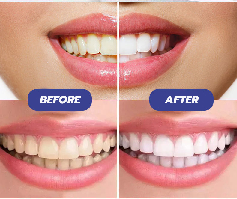 ภาพอธิบายเพิ่มเติมของ 💖บอกลาฟันเหลือง💖 BCLING ยาสีฟันฟันขาว 238g ยาสีฟันเบกกิ้งโซดา ซ่อมฟันเหลือง ขจัดคราบหินปูน​ บำรุงฟัน ยาสีฟัน ยาสีฟันฟอกขาว ที่ฟอกฟันขาว ฟอกฟันขาว ยาสีฟันขจัดปูน ฟันขาว