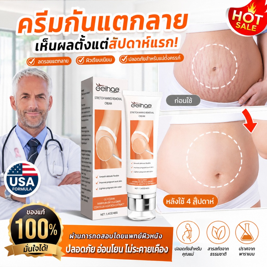 ผลิตภัณฑ์ความงามและการดูแลผิว VIVX Cream to Reduce Stretch Marks on Stomach, Legs, Hips. Apply Inside the Skin for 7 Days, the Marks Will Gradually Disappear, and the Skin Texture Will Be Repaired Well ราคา 55 บาท*ส่งฟรี