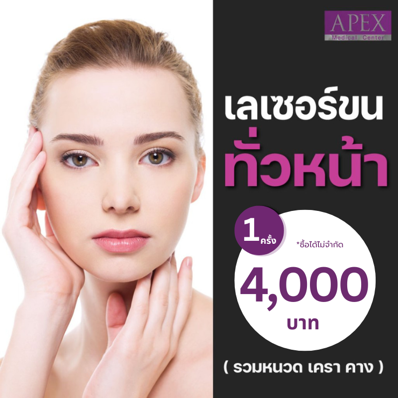 [E-Voucher] Apex Facial Laser for the Entire Face, Mustache, Beard, Chin, Smooth Face, Long-Lasting Makeup, Quick Results, 1 Time Use. ราคา 4,000 บาท*ส่งฟรี