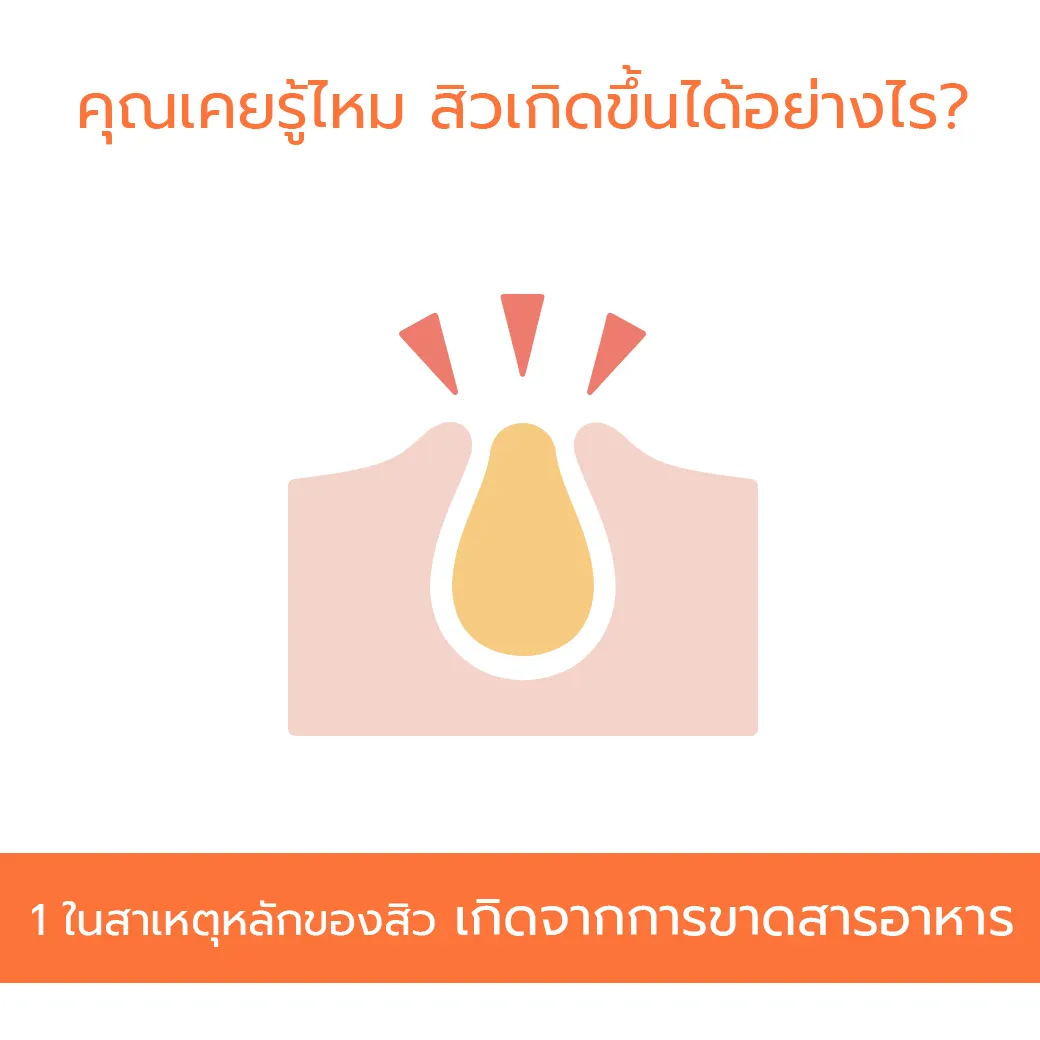 7b50cbcb107e90c2d22c34bca78e591d.jpg_q80