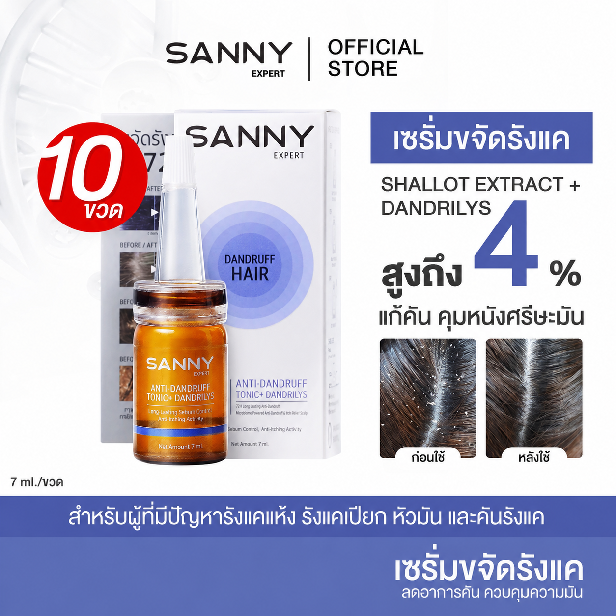 SANNY ANTI-DANDRULFF TONIC PLUS 10 BOTTLE ราคา 1,450 บาท*ส่งฟรี