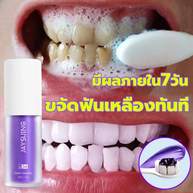 ฟันเหลือง ทำยังไง