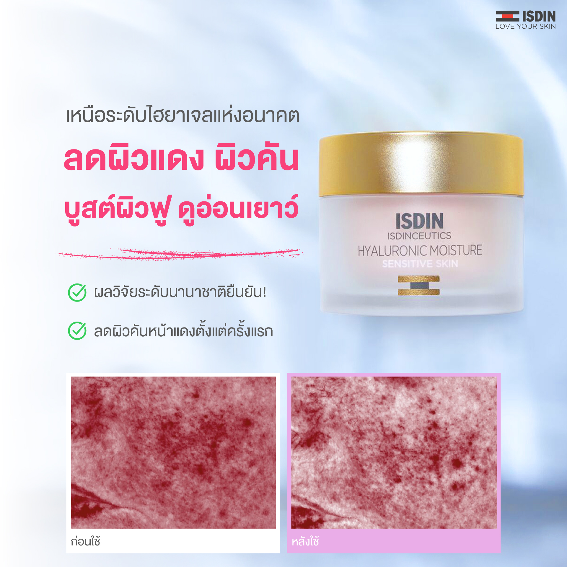 ผลิตภัณฑ์ความงามและการดูแลผิว ISDIN HYALURONIC MOISTURE SENSITIVE เจลครีมลดผิวแดง หน้าแสบตั้งแต่ครั้งแรกที่ใช้ พร้อมดูแล 7 สัญญาณผิวเสียแห่งวัย