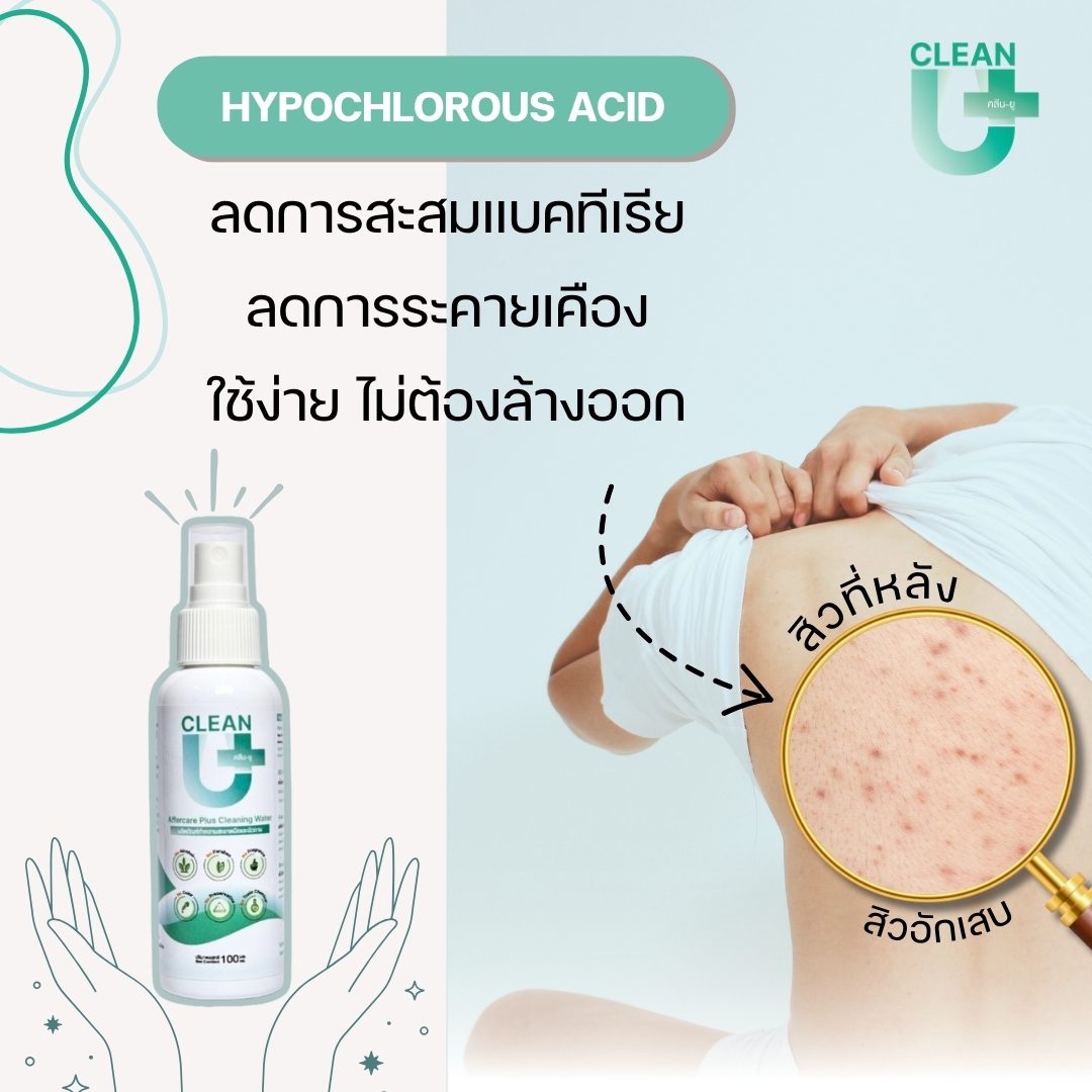 Clean-U Affercare Plus Cleaning water 100 ml >> Hypochlorous Acid << ราคา 229 บาท*ส่งฟรี