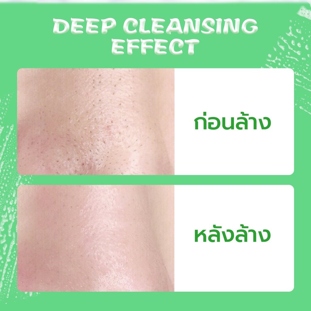 YOU Hy! Amino AC-Ttack Anti-Acne Facial Wash 6 YOU Hy! Amino AC-Ttack Anti-Acne Facial Wash 8af7a32ae0bb8d883d707acb12c28f6f