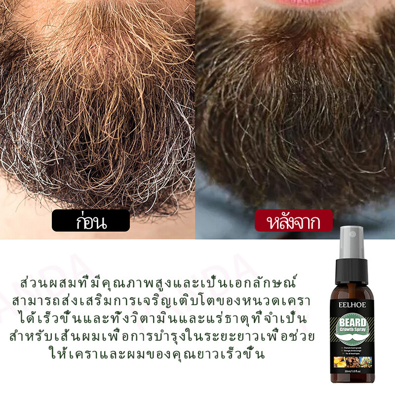 ข้อมูลเพิ่มเติมของ [ในราคาย่อมเยาว์]EELHOEเซรั่มปลูกหนวด 30ml น้ำยาปลูกคิ้วปลูกผมปลูกหนวดปลูกคิ้วยาปลูกผมยยาปลูกคิ้วเซรั่มปลูกผมเซรั่มปลูกหนวดเซรั่มปลูกคิ้ว beardoilยาปลูกขนคิ้ว