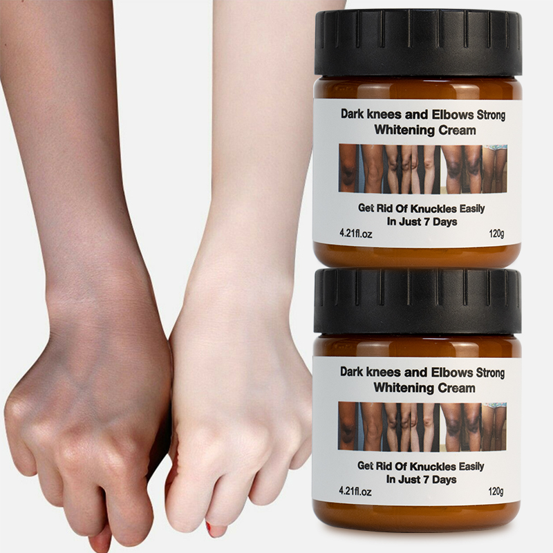 Tự nhiên Arbutin cực làm trắng kem dưỡng ẩm da mặt chống vết thâm lão hóa Lotion chăm sóc da mặt kem làm trắng da chăm sóc da
