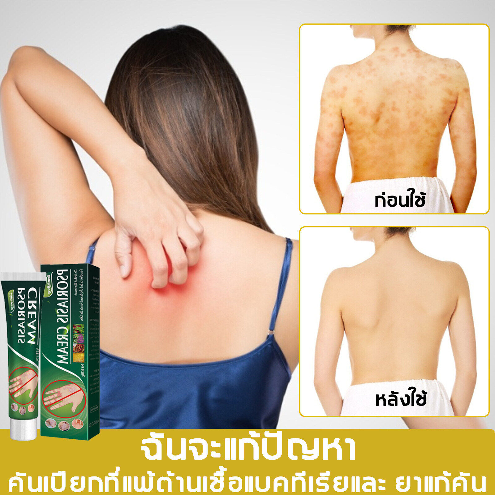 เกี่ยวกับสินค้า 【ใช้ได้ทั้งตัว】สะเก็ดเงิน กลาก ครีมลดอาการคัน ยาทาแก้คัน ผิวหนัง ครีมทาแก้เชื้อรา ทากากเกลื้อน สารสกัดจากพืชใช้ได้ทั้งตัว สารสกัดจากพืชใช้ได้ทั้งต