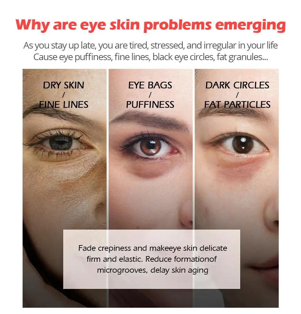 eye puffiness remover