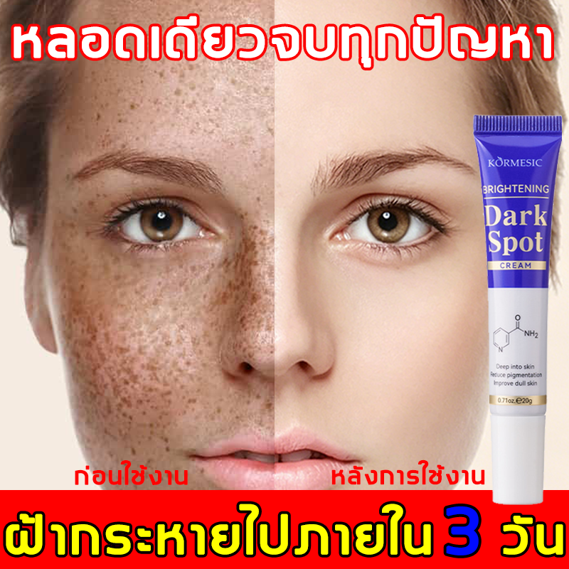 7-Day Freckle Cream Formulated with Niacinamide to Treat Blemishes, Freckles, and Deep-Seated Dark Spots. Also Inhibits the Formation of Melanin. Dark Spot Cream, Eliminates Dark Spots, Permanent Freckle Cream. ราคา 169 บาท*ส่งฟรี