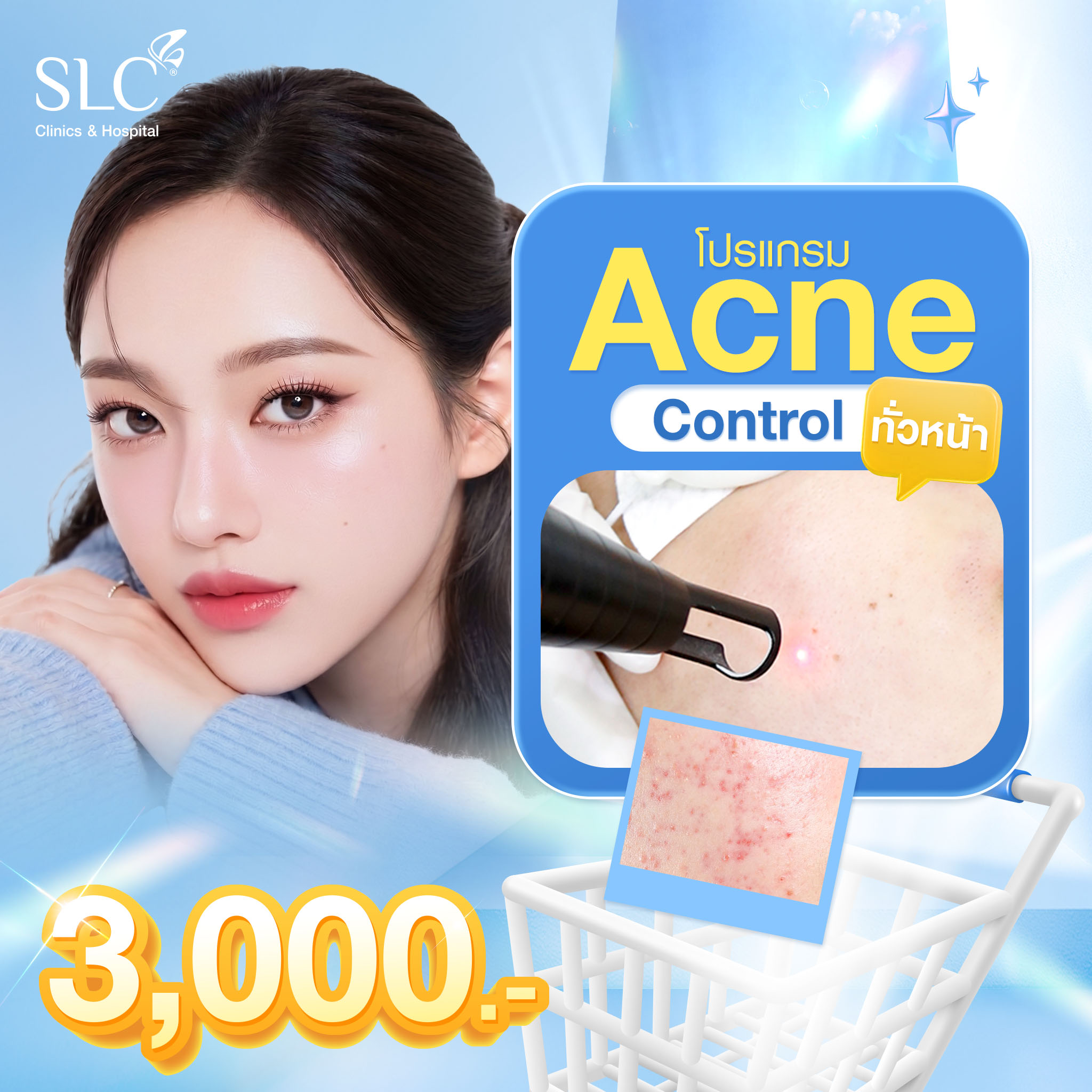 [E-Voucher] Slc Clinic - Acne Control Program (General Program) ราคา 3,000 บาท*ส่งฟรี