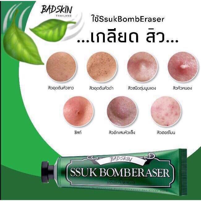 SSUK BOMB ERSSEA BADSKIN( ซุค บอมบ์ อิเรเซอร์ แบดสกิน) ของแท้นำเข้าจากเกาหลี  หน้าใสไร้สิว มากวนใจ