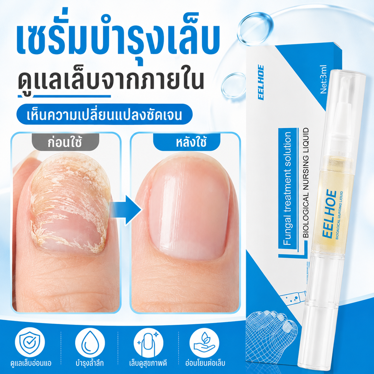 Nail Fungus Medicine Nail Care Serum Fingernail Fungus Treats Fungus on the Nails, Nourishes Nails, Improves Damaged Nails, and Makes Nails Strong and Healthy Within 7 Days. ราคา 149 บาท*ส่งฟรี