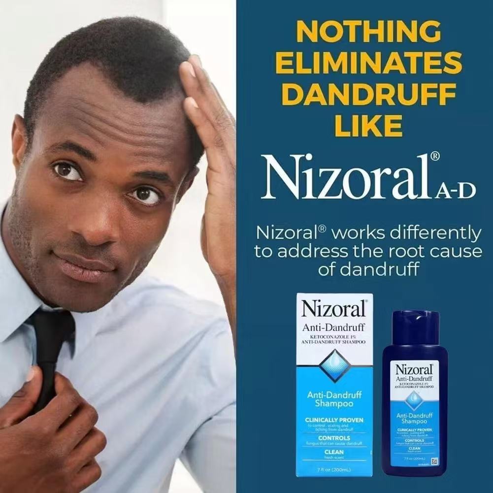 Nizoral Shampoo Eliminates Dandruff: Moisturizes the Scalp, No Itching Anymore. ราคา 249 บาท*ส่งฟรี