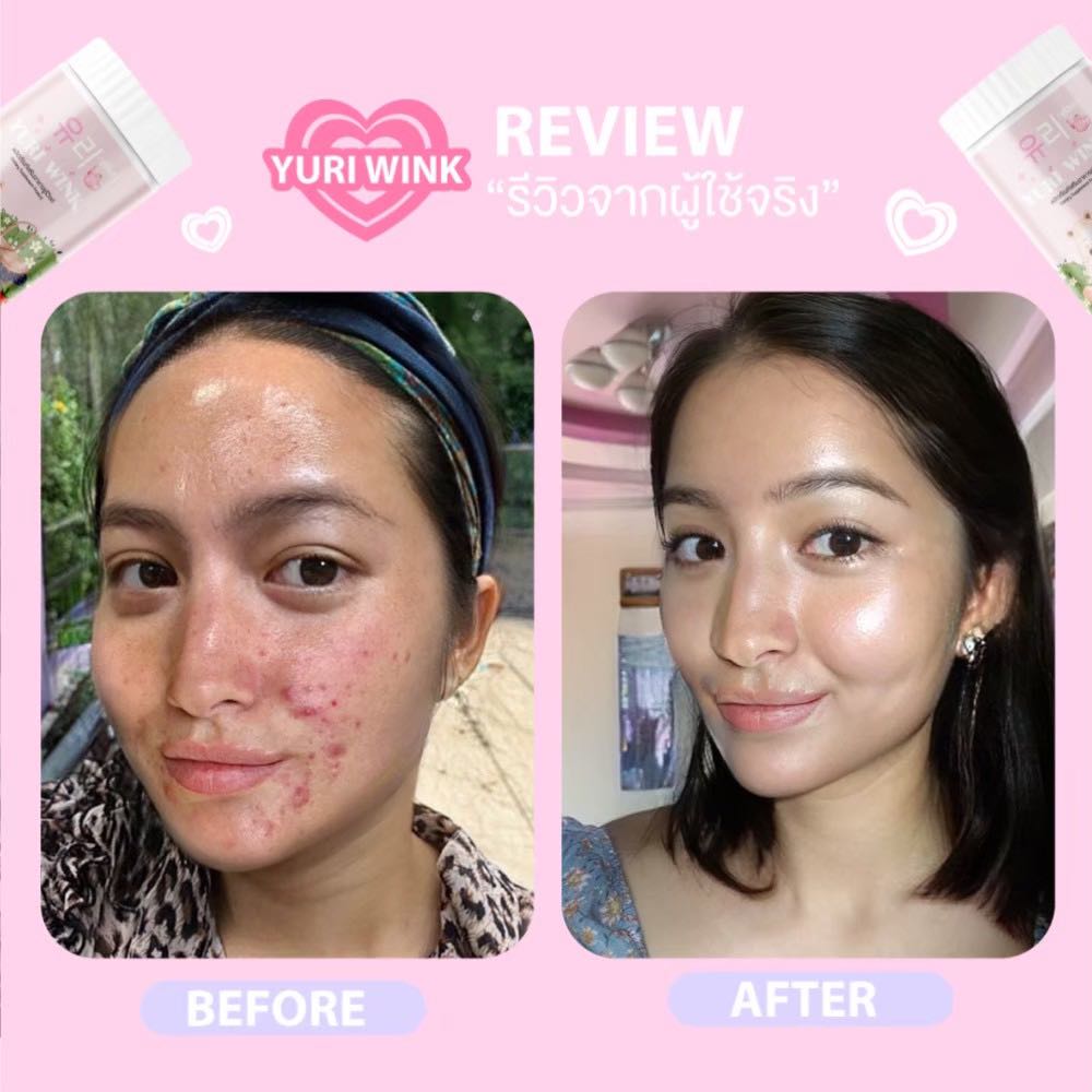 ส่งฟรี 1 แถม 2 พร้อมส่ง 🐣 ยูรีวิงค์ Yuri Wink น้ำชงผิวกระจก น้ำชงผิวใส ออร่า กลูต้า + คอลลาเจน + วิตามินซี ( ยูรี วิงค์ 유리 ) ราคา 290 บาท*ส่งฟรี