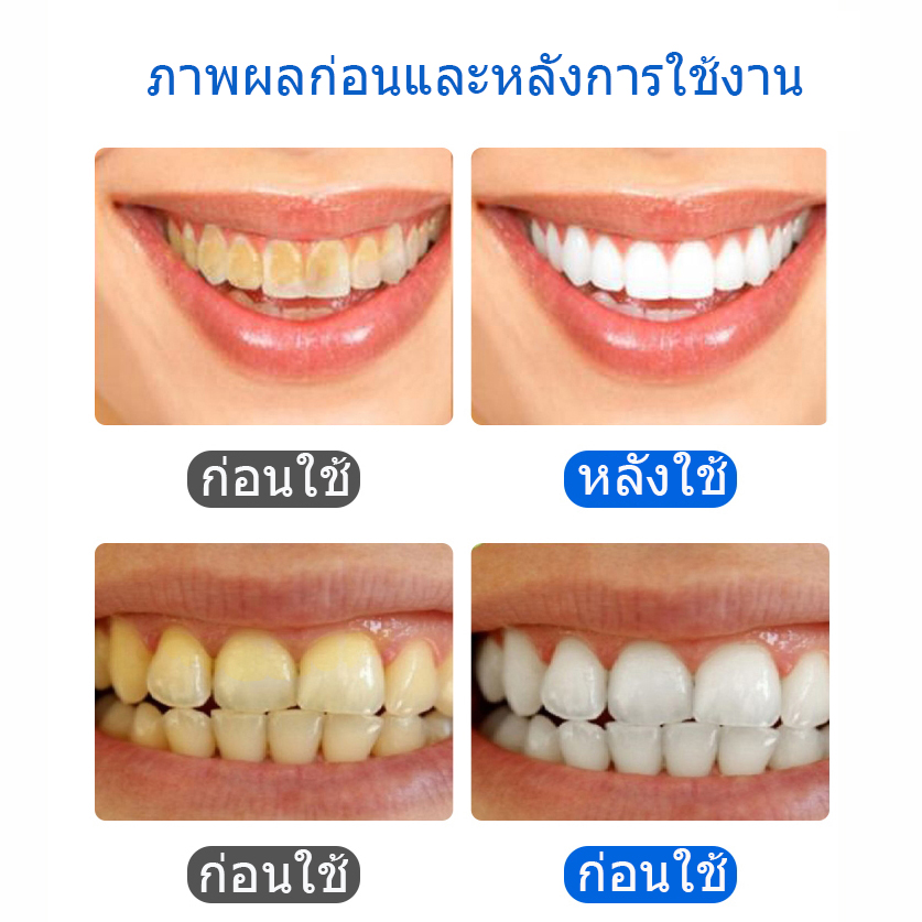 มุมมองเพิ่มเติมเกี่ยวกับ ยาสีฟันเบคกิ้งโซดา สมุนไพร ยาสีฟัน ฟอกฟันขาว ลดกลิ่นปาก ลดครบหินปูนBaking Soda Tooth Protection 220g Toothpaste กลิ่นบรูเบอร์รี่(074)