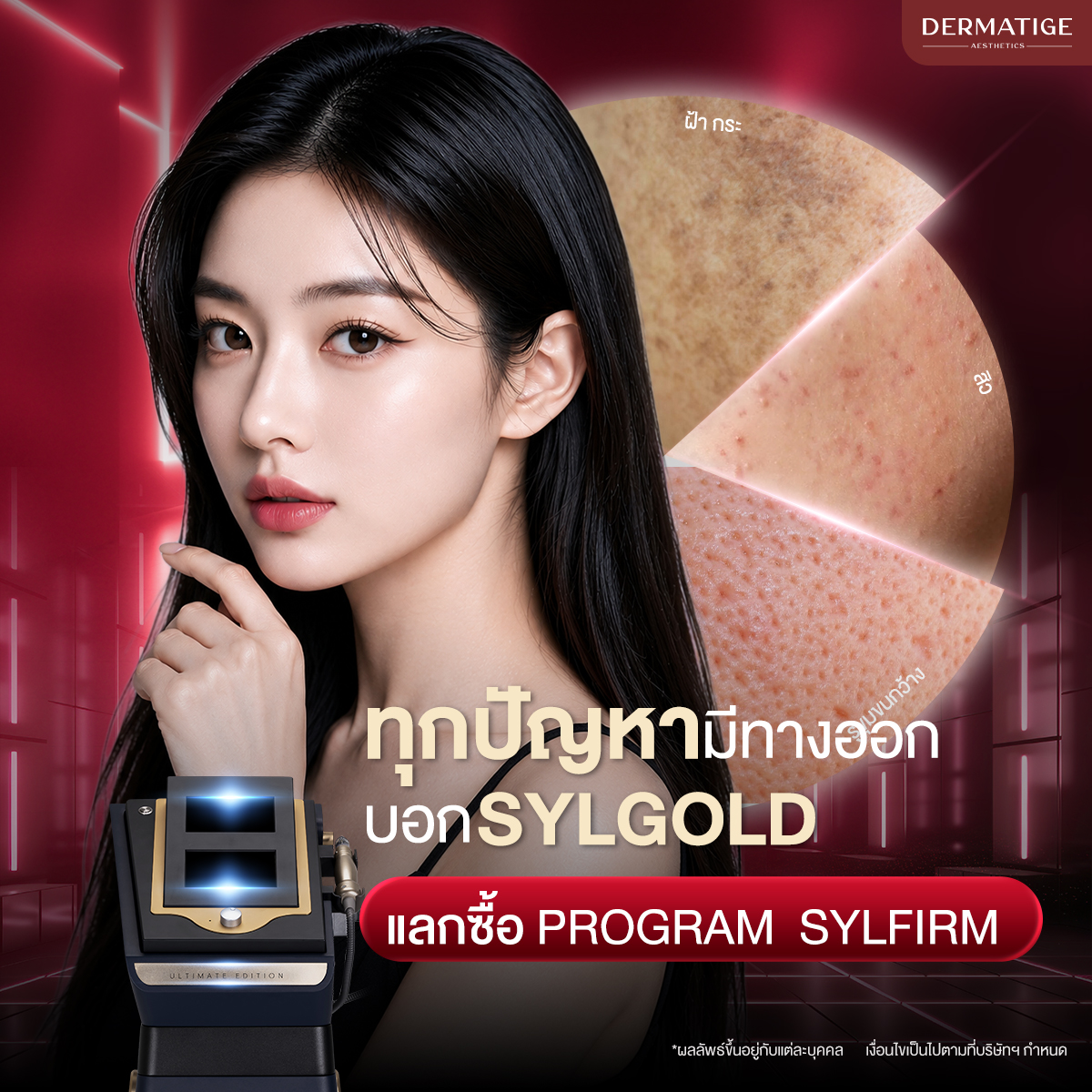 [E-Voucher] Redeem to Purchase Program Sylfirm for 7,990 by Dermatige ราคา 100 บาท*ส่งฟรี