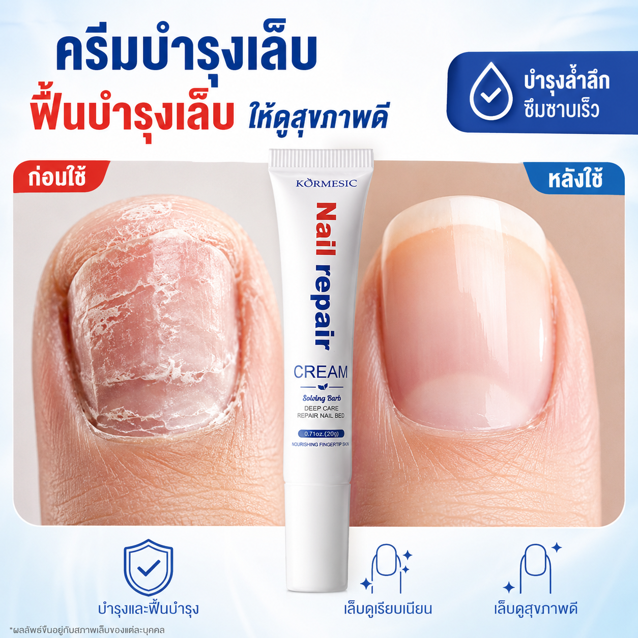 Nail Fungus Medicine Helps Reduce Nail Fungus Problems. Restores Damaged Nails Without Damaging the Healthy Parts of the Nails. Nail Care Serum, Nail Care Cream, Nail Repair Serum ราคา 139 บาท*ส่งฟรี