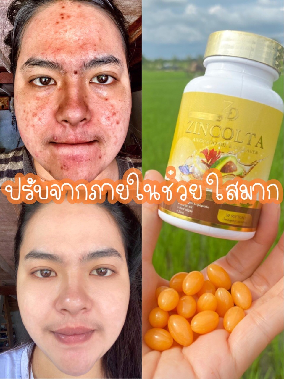 รายละเอียดเพิ่มเติมเกี่ยวกับ ซินคลอต้า Zincolta น้ำมันอโวคาโด้สกัดเย็นผสมคอลลาเจนเข้มข้น 2 แถม 1ส่งฟรีมีเก็บปลายทาง