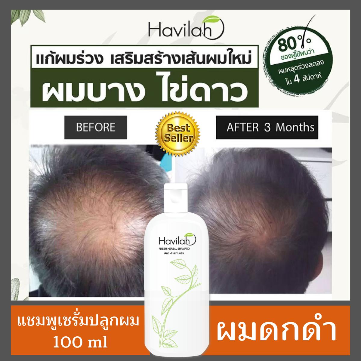 แชมพู เร่ง ผม ยาว